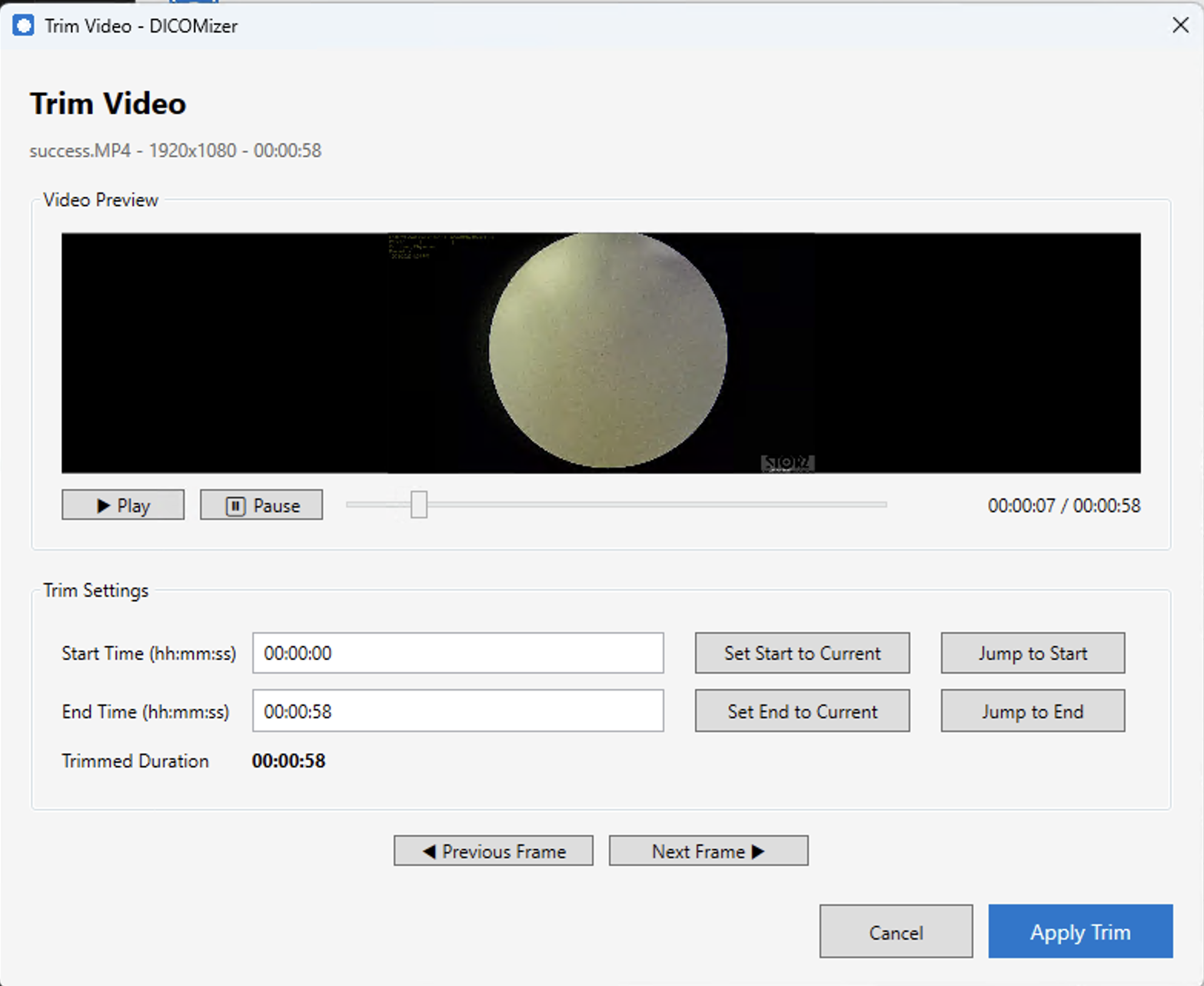 Video trimming with preview
